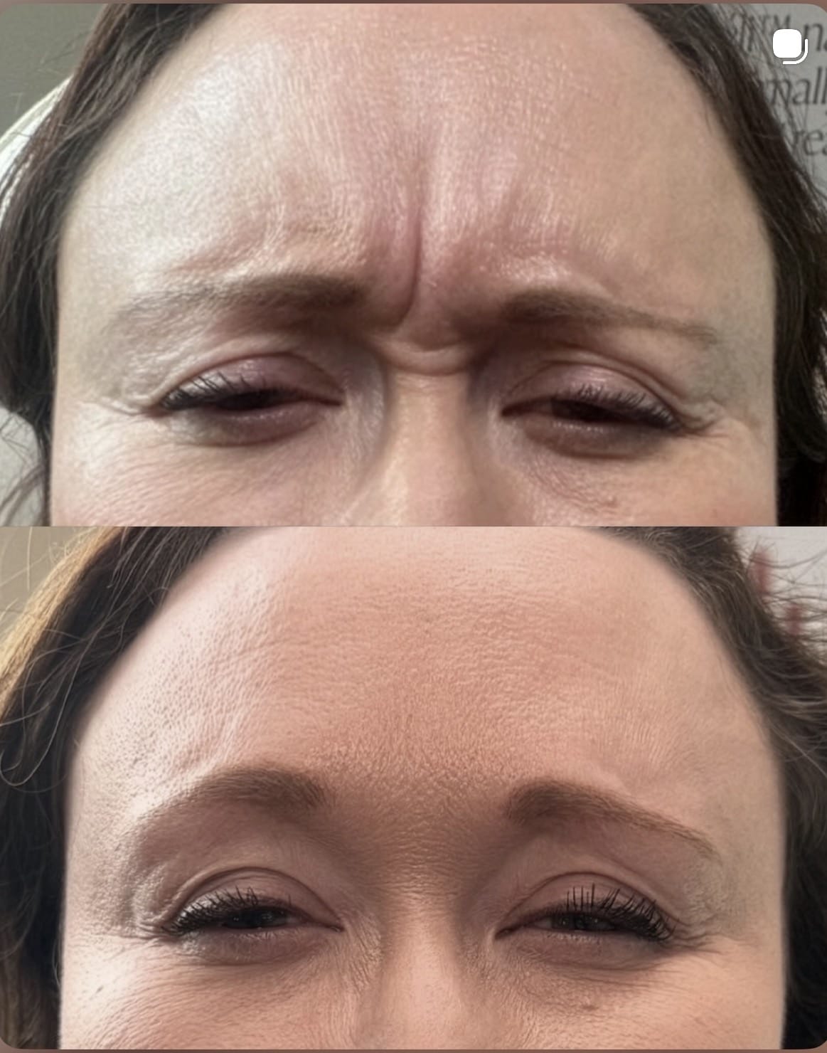 Before and After Image: Tox - front