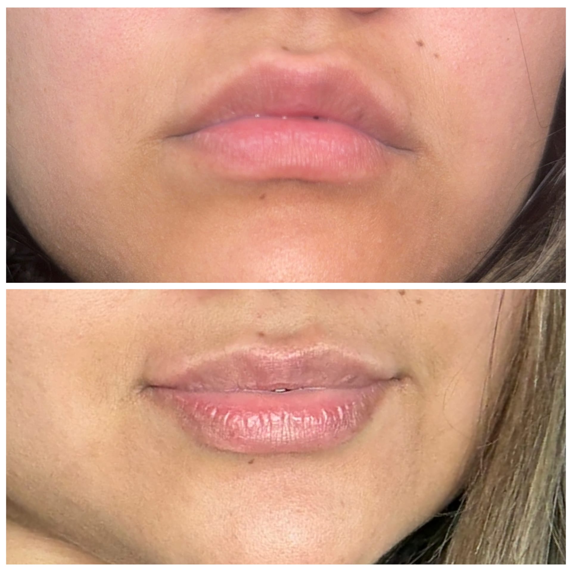 Before and After Image: Tox - front