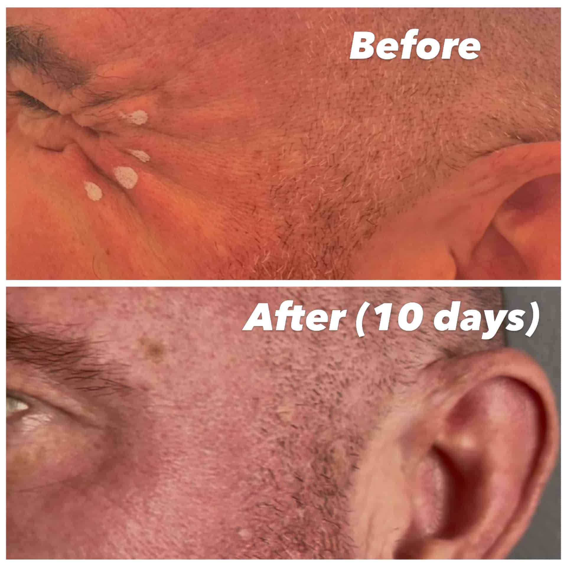 Before and After Image: Tox - left-side